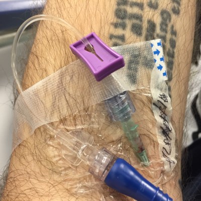 It takes a lot of drugs to pass a kidney stone the first time. Double that to pass one the second time. Shit is not fun!